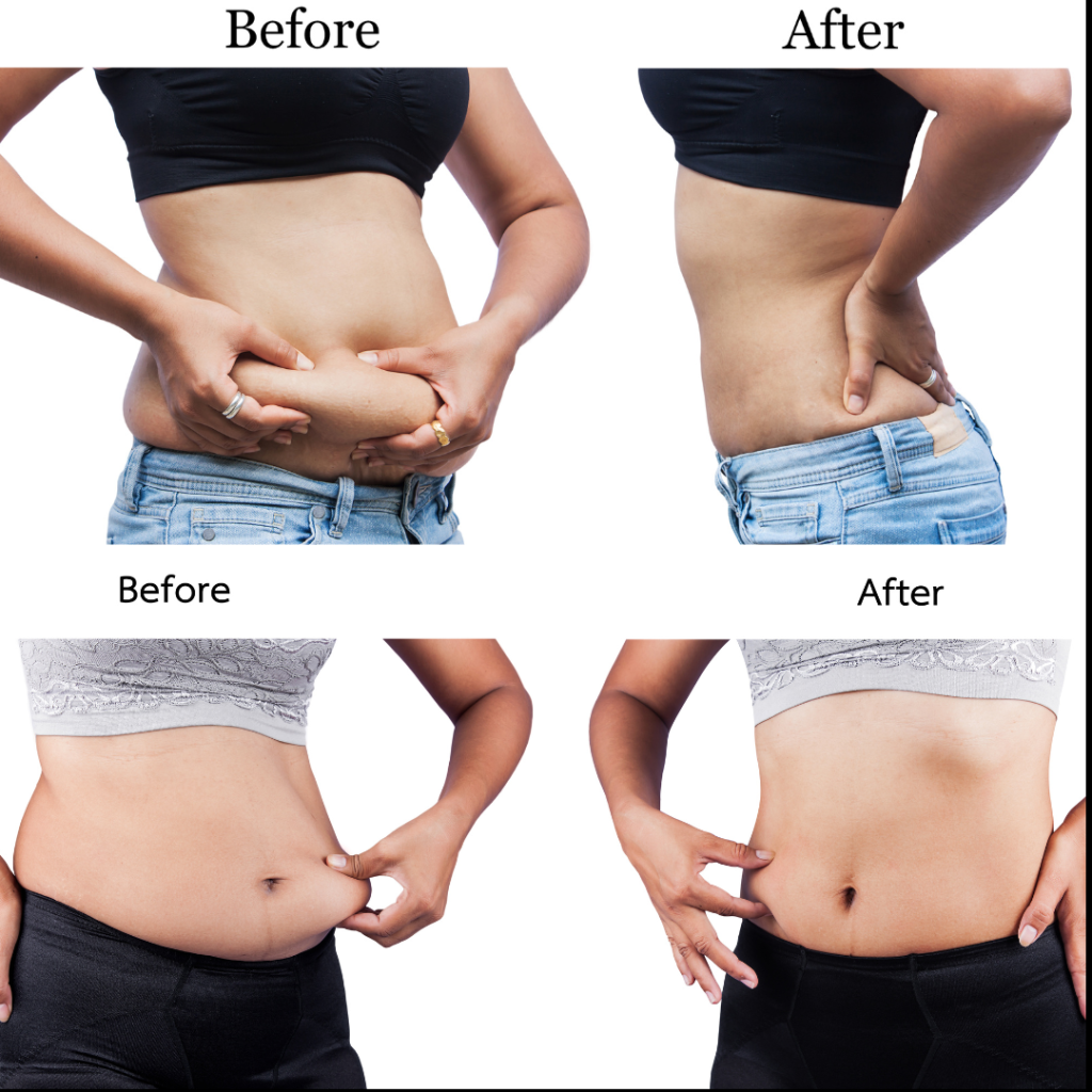 before and after medical weight loss