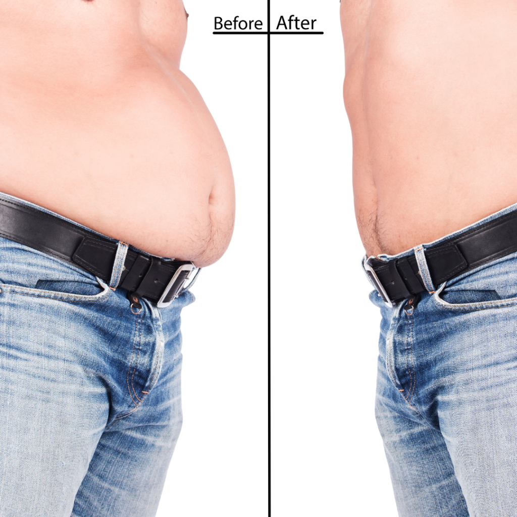 before and after medical weight loss